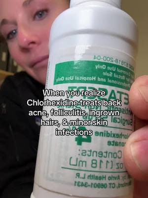 Ever wonder what a dermatologist uses to wash cuts, prevent infections and clear back acne? Chlorhexidine (aka Hibiclens or Hibiscrub). So useful, just don't get in eyes or ears. #backacne #folliculitis #skin #dermtok #dermatology