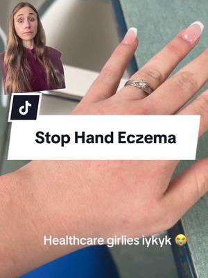 How to prevent hand eczema from wearing gloves. #handcream #handcareroutine #dermatologist @Sarah 