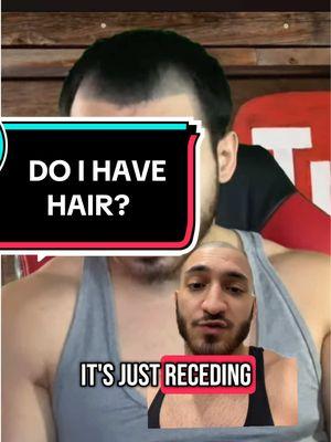 Replying to @iloveGod Can I Grow Hair?🤣🤷🏻‍♂️ #recedinghairline #hairlosssolutions #hairlinetattoo #scalpmicropigmentation #marthreenez #hairtransplant #greenscreen 