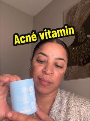 Acné vitamin  #AcneSolutions #SkinCareJourney #ClearSkinGoals #HealthySkinTips #GlowUpVitamins #RetroVibes #VintageSkincare #SkinCareWithStyle #SkinHealthMatters #OPositivHealth