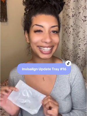 Tray # 16/18 ! Old video but worth posting still 🫣 ask me anything 🤗 #invisalign #teethtok #transformation #braces #teethcare #longformvideo 