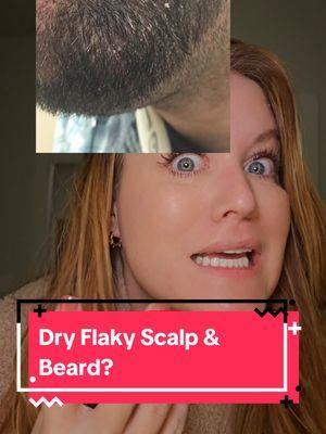 Flaky beard & Scalp treatment under $10! This helped my husband so much with his super dry Beard and scalp. Even behind his ears was dry. #drybeard  #dryscalp #dryscalpremedy  #flakyscalp  #scalptreatment  #glycolicacid 