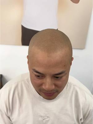 Did we save his hairline? #scalpmicroigmentation #hairtattoo #scalptattoo #fyp #scalpmicropigmentation 