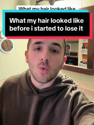 What my hair looked like before I began to lose it. (half of these photos are with my ex’s cuz it was all i could find in my camera roll, pay no mind to that lmao) #hair #hairloss #hairgrowth #hairprogress #haircare #hairline #recededhairline #regrowth #bald #balding #thinning #thinhair #thick #full #products #medication #treatment #finasteride #minoxidil #scalpmassager #rosemaryoil #dermaroller #xyon #xyonpartner #growplex #aimike #rogaine #keeps #hims #propecia #kirkland #topical #foam #liquid #oral #pill #journey #transformation #daily #series #day180 #tutorial #stepbystep #routine #regimen #results #proof #beforeandafter #slowlybutsurely #trusttheprocess #followalong #explanation #education #explained #DHT #hairfollicles #baldspot #howto #consistency #everyday #nevergiveup #positivity #motivation #hairtok #fyp #viral #xybca #chris #zeph #ibby #freddy #turkey #vitamins #biotin #hairtransplant #grafts #donorarea #complex10 #suppliment #prescription #hairfibers #hairfiller #fibers #veraclinic #mane #maneexlirblend #maneoils #maneoilblend #price #turkey #istanbul #medicatedlotion #lightlytap 