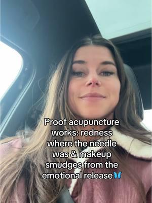 I think I just healed a mother wound I thought I had in that session 🥹🥹🥹 #acupuncture #preconception #naturalremedies #ancienthealing #healthcoach #rootcause #holisticwellness #tcm #traditionalchinesemedicine #mindbodysoul 