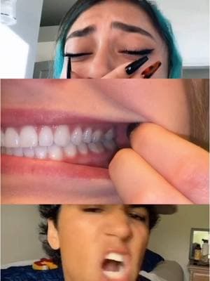 Is your bite perfect? 🦷 Here’s how to tell #orthodontist #dentist #dentistry #braces #bite #teeth #retainer #invisalign #stitch with @avani @Michelle 🌸 @Brendan Bobo 