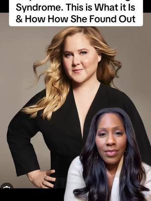 Amy Schumer has Cushing’s Syndrome  #cortisol #cushingsdisease #cushingsyndrome #cushings #amyschumer #amyschumerface #moonface #driencaudle #fyp #fypシ #fypage 