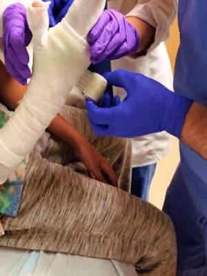 The Doctor Help Special Child Girl Cast Arm In Hospital 😱 #cast #casting #castarm #brokenarm #brokenbone #cutting #helps #doctorstrange #fyp #emotional #hospital #satisfying 