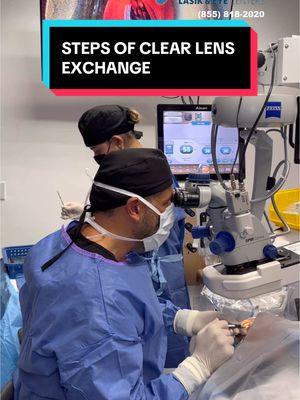 Watch this video to see all the steps of a clear lens exchange #tiktok #LearnOnTikTok #viral #fyp #clearlens #lensreplacement #lensexchange #cataract #surgeon #surgeonsoftiktok #eyesurgery #eyesurgeon #ophthalmology #ophthalmologist #foryou #doctorsoftiktok #lens #vision 