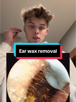 How was that in my ear #viral #earwaxremovalvideos  #CapCut 