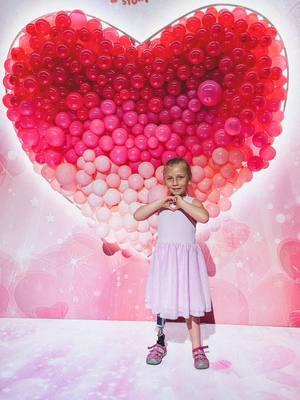 Let the countdown begin!! Ending Friday with a flashback to Talia’s first steps! 💫 Born with congenital tibial hemimelia, her parents made the brave decision for an above-knee amputation, opening the door to a life of mobility and endless possibilities. 💕 Now 7, Talia is fearless, thriving in sports, and embracing every challenge with joy. 🦾🦿 Her journey is proof that anything is possible! ✨ Learn more and follow us on Instagram for more inspiring stories! 😉 #amputeestrong #limbdifference #tibialhemimelia #amputeeinspiration #flashbackfriday 