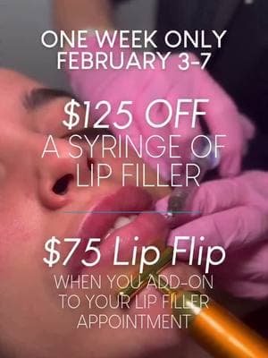 Have you booked your lip filler appointment? Give us a call today or head to the link in our bio to book your lip filler appointment for our Filled with Love event (2/3-2/7)! Enjoy $125 OFF a syringe of lip filler + $75 lip flip when you add-on to your lip filler appointment👄#weilerplasticsurgery #filler #fyp #injectables #event #lip #lipfiller 