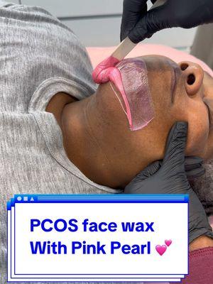 PCOS face wax with @Wax Wax Pink Pearl 💕. Link in bio to book  #waxing #pcos #pcosawareness #pcosproblems #pcosfighter #pcoslife #pcoswarrior #pcoslife #pcossupport #esthetician #estheticianlife #skincare #fyp