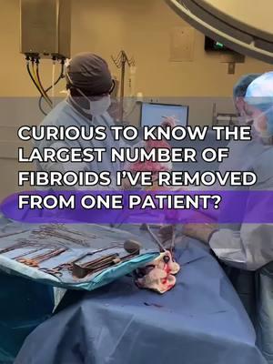 When I tell people how many fibroids I’ve removed in one surgery, they’re always shocked😳. This number still blows my mind.   I’m on a mission to help women reclaim their health and break the cycle of silence around women’s health issues. Join my private community and connect with like-minded women who are ready to take charge of their health. Click the link in bio to join!  #FibroidAwareness #fibroids #fibroidsolution #fibroidfree #fibroidssuck #womenhealth #womenhealthtips #womenhealthmatters #chicagodoctors #doctorsofinstagram #fibroidslayer #fibroidsurgery 