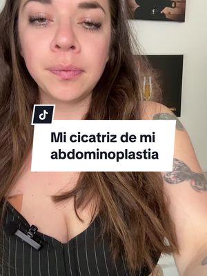 Me pidieron muchoneste video! #cicatriz #abdominoplastia #lipo #cirugiasplasticas #cirugiaestica #cirugia 