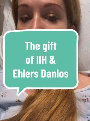 Sometimes I wonder the things I could accomplish if IIH didn’t set me back just a little. Idiopathic Intracranial Hypertension (IIH) is a rare brain disease where your body mimics you having a brain tumor… You just don’t have one. My head and my face are often full of spinal fluid, which puts pressure on everything… including my vision.  I never realized how important my vision was until this. It’s something we never think about and we often overlook.  But, it still doesn’t stop me…  Me and my spinal fluid are besties… Tons of love to my fellow IIH, endometriosis, Ehlers-Danlos, and all the invisible illness warriors ❤️ ##idiopathicintracranialhypertension##iih##invisibleillness##ehlersdanlossyndrome##ehlersdanlos##eds