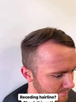 The best solution to receding hairline 😍 #hair #hairtok #haircut #hairsystem #hairstyle #toupee #hairreplacement #hairunit #menshair #barberlife #salon #menswigs