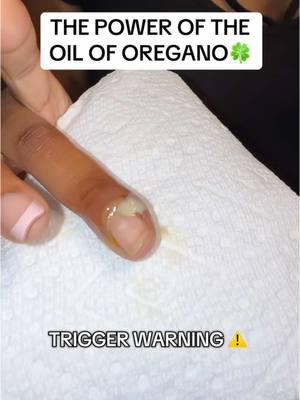 my mom heard a sniffle or a cough n would RUN n feed me those oil of oregano lmaoo… although i HATED it i never complained cuz it’s a legit HEALER!! n the capsules just took it to another level 🤯😩 #oiloforegano #oreganooil #strepthroat #remedy #healthhacks #healing 