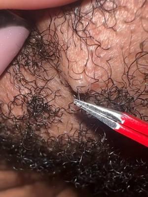 #isthisasmr #asmr #satisfyingvideo #foryou #fypage #fyp #foryoupage #fy #zoomedin #insidethebeard #boyfriend #extractions #ingrownhair #facial 