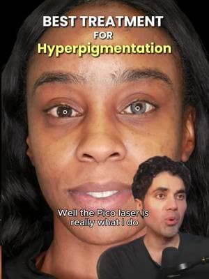 Treating pigmentation requires precision, especially when working with patients across the entire Fitzpatrick scale. With my Pico laser, I customize the settings to safely and effectively target pigmentation without overheating the skin or causing unnecessary damage. This tailored approach allows me to treat a wide range of skin tones, from Fitzpatrick 1 to 6, while minimizing the risk of post-inflammatory hyperpigmentation (PIH). If you’re curious about how pigmentation treatments work or how lasers are customized for your skin type, join me live Monday through Thursday at 9 PM PST on TikTok, YouTube, and Instagram. I’ll be answering your questions, sharing real results, and breaking down the science behind the treatments I perform every day. Self-book your consultation today at doctorqazi.com Call/text: 949-336-7293 Whatsapp: +1 (714)-860-6945 20271 SW Birch St Suite 100, Newport Beach, CA 92660 #acnescars #acnescartreatment #acnescar #pigmentation #melasma #picolaser #acne #doctorqazi #qazicosmeticcenter #dayinthelife #doctorvlog #NewportBeach #co2laser #ablativeco2laser #sculptra #siliconetape #skintape