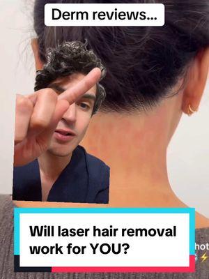 stitch with @Beam Laser Spa  Laser treatments can be a great way to remove hair that you don’t want or like. It’s important to realize that this isn’t a permanent removal and that the hair will come back (although it will be much thinner). These lasers also target the pigment (color) in the hair, so they work best on darker hair and won’t work on white hairs. #laserhair #hairremovallaser #laserhairremoval #hairremovaldevice #hairremoval 