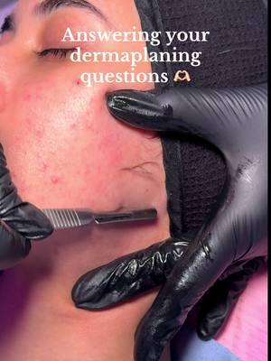 Comment any other questions you guys have 🫶🏻  #dermaplane #dermaplaning #facial #facialtreatment #skin #skincare #acne #medspa #glassskin #acne #longisland #newyork #beauty #girls #trending 