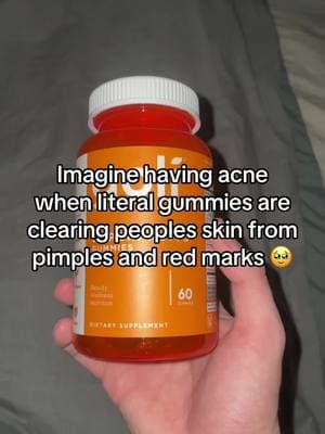 So amazing 🤩 #acnetreatment #acne #skincare #pimples #skinhacks #glowuptips #acneskin #skincaretips #glow #healthyskin #beauty #goli #wellness 