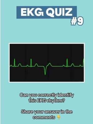 #firefighter #paramedicsoftiktok #emtsoftiktok #nremt #cardiology #ekginterpretation #healthcareworker #ambulancedriver #paramedicstudent 