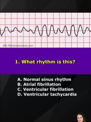 Nurse ECG (EKG) Rhythm Quiz for Nursing School Students and NCLEX Review Can you identify the ECG Rhythms in this quiz? You'll learn about common ECG rhythms in nursing school. #ecg #ecginterpretation #nursesoftiktok #nurse #nursing #nursingschool #LearnOnTikTok #srem #ekg #nursetok #fyp #foryou #learn #nursingstudent 