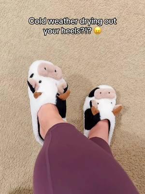 🥰🦶👣🧦 Say good bye to those dry heels! Click the link above! #feet #heels #dry #heelsocks #fuzzy #moisturizer #moisturizing #overnight #crackedheels #crackedheelstreatment 