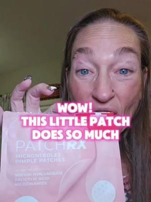 If they stay any longer, i'm going to start charging rent. I need something quick easy and effective. PatchRx Pimple Patches for Face. @PatchRX #patchrx #pimple #pimplepopping #pimplepopper #pimplepop #acne #acnetreatment #acneskin #acnescars #zit #zits #teatreaoil #fasthealing #clearskin #easytouse #easytosetup #easytouseproducts #simpletouseandapply #vegan #easytoremove #skincare #skincareroutine #morningskincareroutine #nightlyskincareroutine #healthyskin #glowingskin #softskin #smoothskin #moisturizing #DailyRoutine #daily #dailyuse #skincarerepair #beauty #beautycare #SelfCare #selfcareroutine #selflove #skincareproducts #skincareaccessories #skincareessentials #musthaveproducts #musthave #multipurpose 