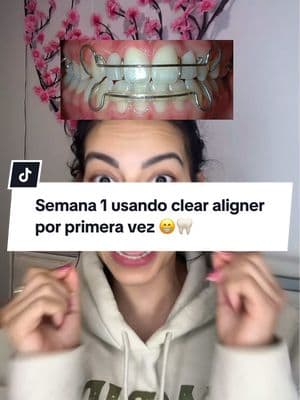 Semana 1 usando clear aligner por primera vez 😁🦷 #clearaligners #aligners #alignersjourney #alignerupdate #mottoclearaligners #higienebucal #cuidadobucal #whitesmile 