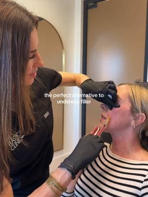 Read here to learn more ✨ PRF EZ Gel is THAT GIRL. PRF EZ Gel is a treatment for under-eye areas that helps reduce dark circles, puffiness, and fine lines. It uses platelet-rich fibrin to promote skin regeneration and enhance collagen production. The result is smoother, rejuvenated skin with minimal downtime. ✨💉  #eyefiller #prfgel #undereyefiller #filler #biostimulator #esthetician #injections #injector 