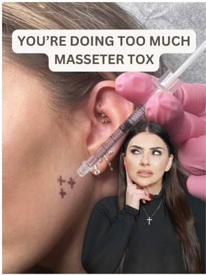 Overdoing Masseter Tox? Stop That. 💉🚫 Unless it’s for TMJ or migraines, you DO NOT need masseter tox every three months. Too much = muscle atrophy, indentations, visible parotid glands… then what? More tox? Fillers? A facelift? Moderation is key. Twice a year is enough for aesthetic slimming.  More isn’t better…smarter is. 👏🏼 #massetterbotox #masseterinjection #tmjtreatment #tmjbotox #muscleatrophy #nunestepanyan #thestepanyanclinic 