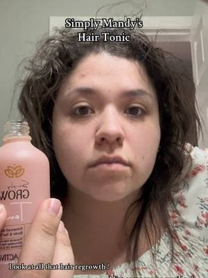 Simply Mandy’s hair tonic #simplymandys #hairtonic #growhair #hairtok #myresults #crecimientodelcabello 