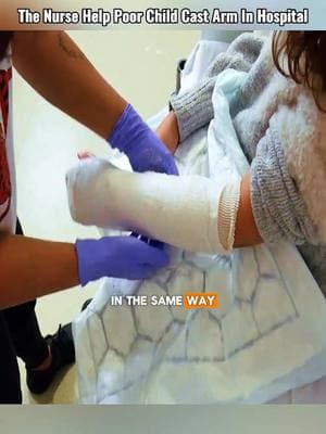 The Nurse Help Poor Little Girl Cast Arm In Hospital 😱 #cast #casting #brokenarm #brokenbone #helps #doctorstrange #nursesoftiktok #cutting #fyp #emotional #satisfying #hospital 