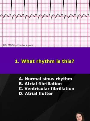 Nurse ECG (EKG) Rhythms POP Quiz for Nursing Students, NCLEX, and Nurses Test your knowledge of common ECG rhythms you'll want to know. How many rhythms did you identify correctly? #ecg #foryou #ecginterpretation #fyp #nursingstudent #nursingschool #nursetok #stem #LearnOnTikTok #learn #nurse #nursing #ekg 