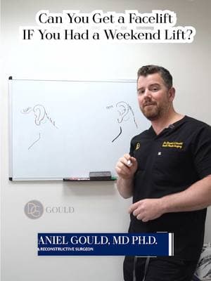 Considering a Weekend Lift but wondering if you can have a Facelift later on? Follow along as I explain what we do in both procedures, and why you CAN have both procedures.  Want to learn more? Give our office a call ☎️ (310) 210-6941 📧 Care@drgouldplasticsurgery.com for a consult. Link in bio if want more info. . . . #weekendfacelift #weekendlift #facelift #crevassetechnique #faceliftsurgery #faceliftresults #deepplanefacelift #fattransfer  #necklift #preservationfacelift #weightloss  Remember, cosmetic surgery comes with risks, including rare but serious outcomes. Stay informed and make choices wisely