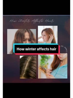 How winter affects hair ✨ #flakyscalp #dandruff #haircare #hairoiling #hairgrowth 