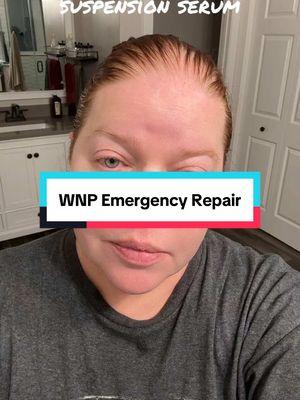 I have been so sick lately with a fever and a cough. My skin definitely isn’t looking it’s best. This is a skincare emergency!! I’m using the WNP Emergency repair and Firming Oil Suspension Serum to bring life back into my skin. This uses oil and water to bring out the best results!! #creatorsearchinsights #skincare #skincareoftiktok #fyp #genxtiktokers #genx #over40 #over40andfabulous #viralvideo #yvonnelovesmakeup #skincareover40 #emergency #wnp  @WNP SKINCARE 