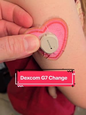 Dexcom Change for the Aquarius #diabetes #t1d #diabetestype1 #dexcom #dexcomg7 #expressionmed 