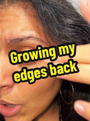 Growing my edges back and my hair down to my hips 🫶🏾 #growingmyhair #growingmyedges #edgesgrowingback #minoxidil #minoxidilhairgrowth #minoxidilforwomen #breobrush #scalpmassager #carrotoil #hairbreakage 