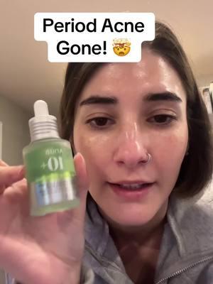 Soooo…I did not research Azelaic Acid enough because why have I not been using it sooner?! @Anua Store US serum includes hyaluronic acid for hydration to make a perfect serum. #azeliacacid #anua #periodacne #hyperpigmentation #acne #acnetips #skincareforredness #skincareforbeginners #bestserum #skincareforhyperpigmentation #t#ttshopdelightnowg#giftguidel#lovelanguageseasonalgems  