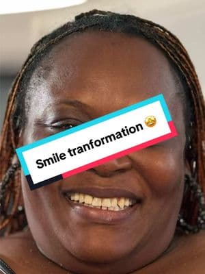 We love a smile transformation 🤩🦷💛 #glogoodfoundation #letloverule #dentalcare #smiletransformation #dentistry #bahamas #givingback #newsmile 