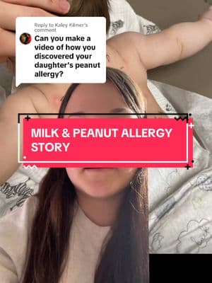 Replying to @Kaley Kilmer I don’t like sharing too many pictures like this out of the sake of my daughters privacy but I hope this helps! #foodallergymom #peanutallergy #milkallergy #anaphylaxis #fyp #greenscreen 