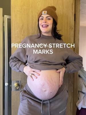 Getting stretch marks during my last pregnancy was something that really devastated me in the moment. It was hard to feel like I was the only person getting them based on what I saw on social media. I want to share this in case you are also struggling with it 🫶🏼 #32weekspregnant #pregnancy #stretchmarks #pregnancystretchmarks #pregnantbelly #pregnantlife #thirdtrimester 