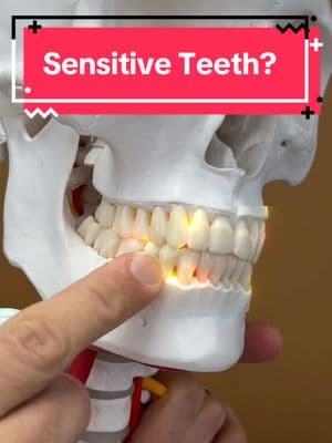 Comment questions or experiences with this below! Do you have sensitive teeth? One cause you might be surprised by his acid reflux… Even if you ‘ don’t have it’. You see there’s something called silent reflux, and it doesn’t feel like the traditional burning in the throat. Instead, there’s other signs that are very prominent what you may have never realized are coming from acid reflux.  In this video, I list some of the most common signs along with five things to do immediately to start reducing reflux. You see the acid from reflux can damage enamel on teeth and that is what can be making them more sensitive of our time. So if you can prevent the reflux, you can protect the teeth and reduce tooth sensitivity. This is more of a root cause fix compared to just brushing your teeth with something that makes them feel less sensitive! Comment your questions or experience with this below! #acidreflux #sensitiveteeth #sensodyne #dentistryworld #dental #toothache #reflux #tmj #tmd #neckpain #neckpainrelief #headaches 