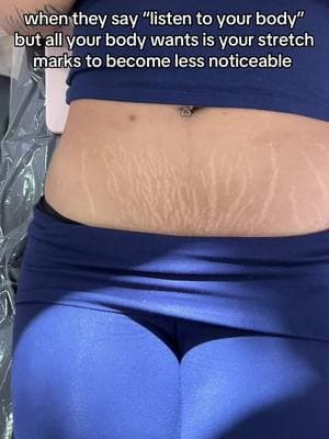 The difference after one session is crazy 😍 bye bye stretch marks! #enluvbeautylounge #stretchmarkremoval #stretchmarkcamouflage #braziliancamouflagetattoo #paramedicaltattoo #paramedicaltattooartist #stretchmarksolution #tattoostretchmarks #stretchmarksremedy #stretchmark #stretchmarksbegone #braziliancamouflage #stretchmarktattoo #inklessstretchmarkremoval #postpartumbody #stretchmarktraining #stretchmarks 