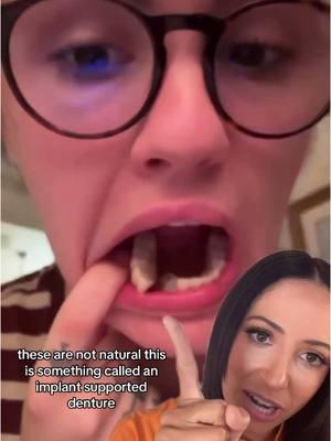 The comments on this original video are wild! Many are asking why her gums aren’t bleeding and how multiple teeth are moving at once. Here’s the scoop: these are not natural teeth; it’s most likely an implant-supported denture where the teeth are securely screwed into implants in the bone beneath the gums. It appears that the denture portion has cracked or broken in one spot, causing the movement. No need to worry—this wouldn’t happen with natural teeth! I hope this clears up any concerns! #denture #denturesmile #dentures #dentalimplant #implantsupporteddentures #rdh #dentist #dentists #dentalassistant #teeth #mouth #dental #dentalhygiene #dentalhealth #dentalcare #dentaloffice #smile #looseteeth #wigglytooth #loosetooth 