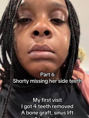 Part 6 after I got my first round of work! #missingteeth #veener #fyp #dentalwork #isntabul #veeners #sideteeth #isntabul #weightlosssurgerysideeffects #implants #bridges #rootcancaltreatment 